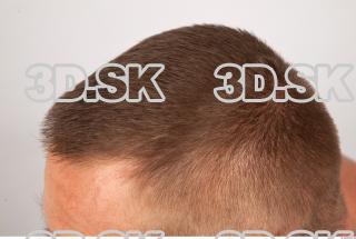 Hair texture of Gene 0007